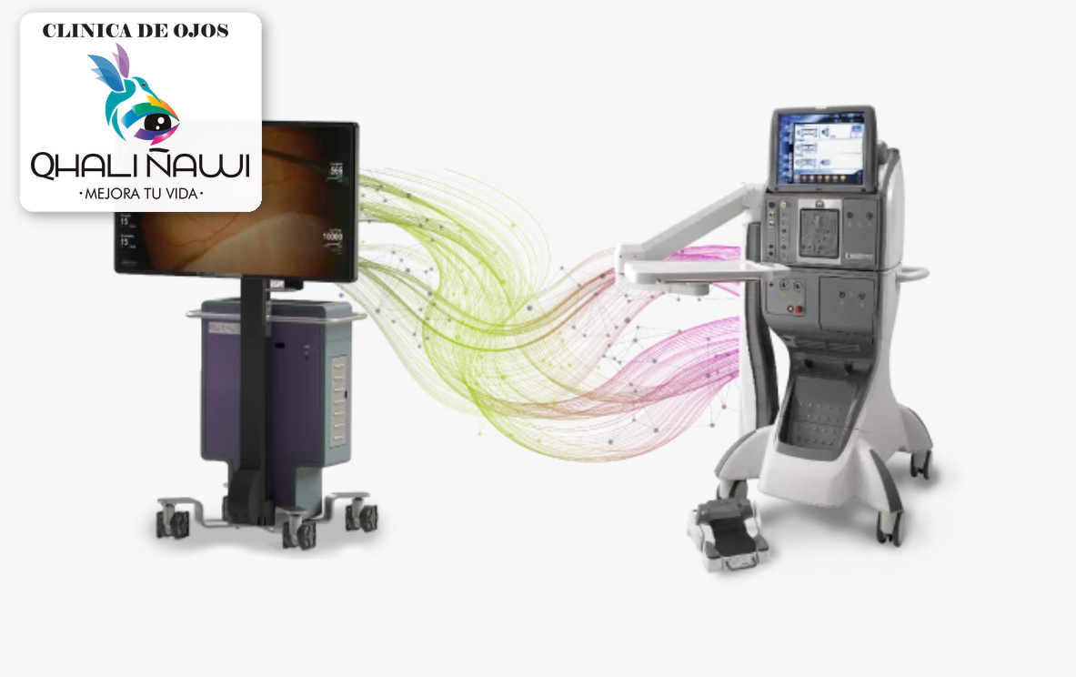 Vitrectomía Constellation Ngenuity 3D