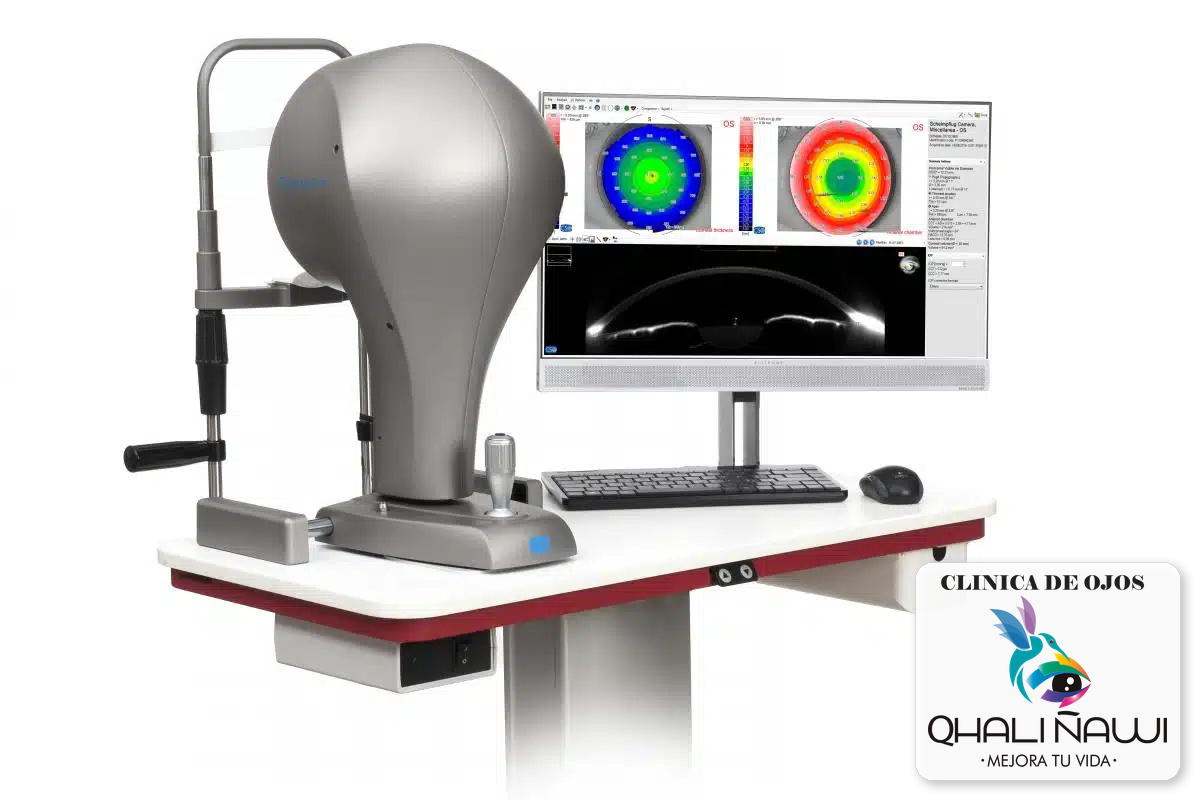 Paquimetría corneal espesor MS39
