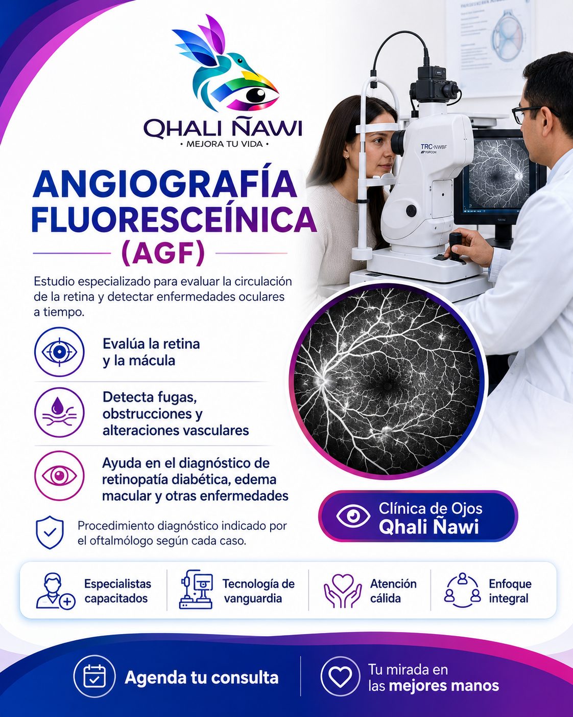 Angiografía fluoresceínica retina diabética